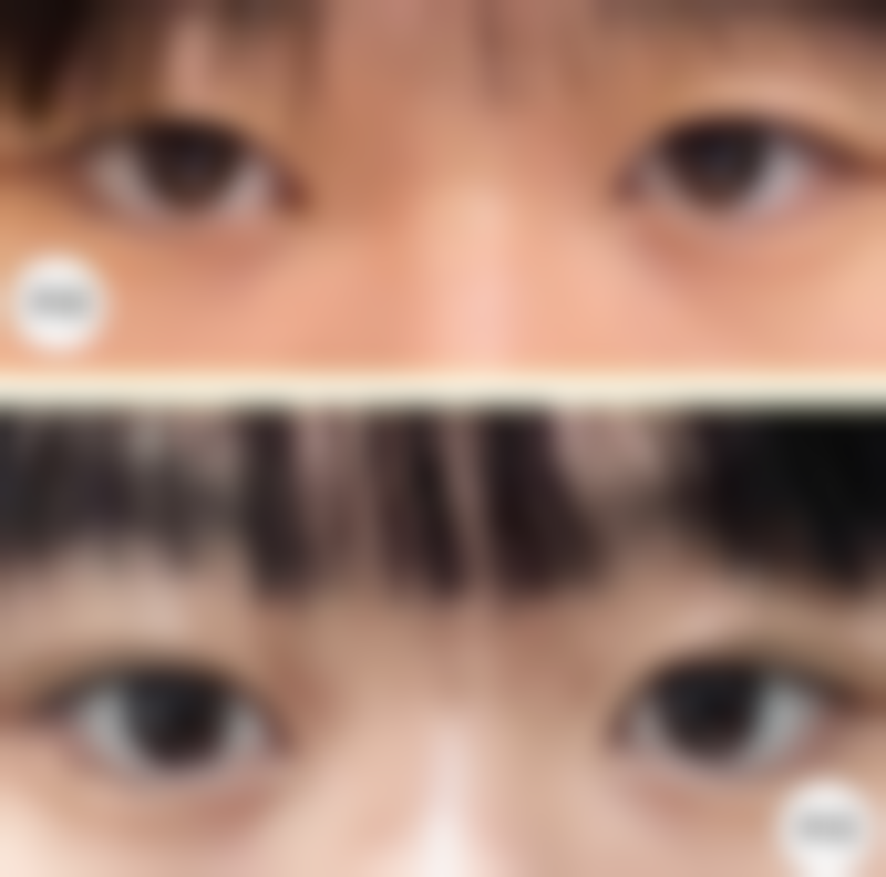 二、郑州至美医疗美容白衡翼医生擅长项目