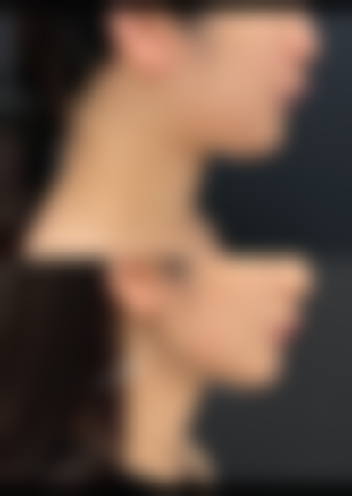 六、郑州至美医疗美容白衡翼医生口碑评价及真人实例反馈