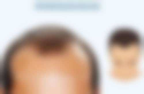 五、南京中天皮肤病医疗美容程玉玲医生技术怎么样？