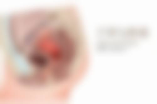 激光去眼袋：高新科技的温柔呵护