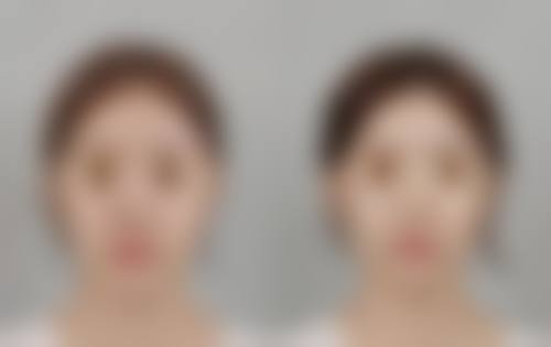 六、北京伊美尔任晋华医生口碑评价及真人实例反馈