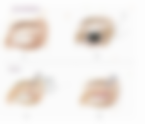 其他去眼袋方法：多元化的选择