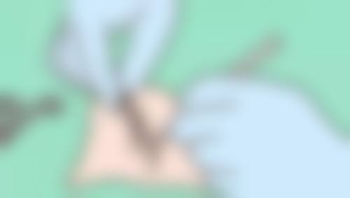 六、深圳港龙医院私密徐小辉医生口碑评价及真人实例反馈