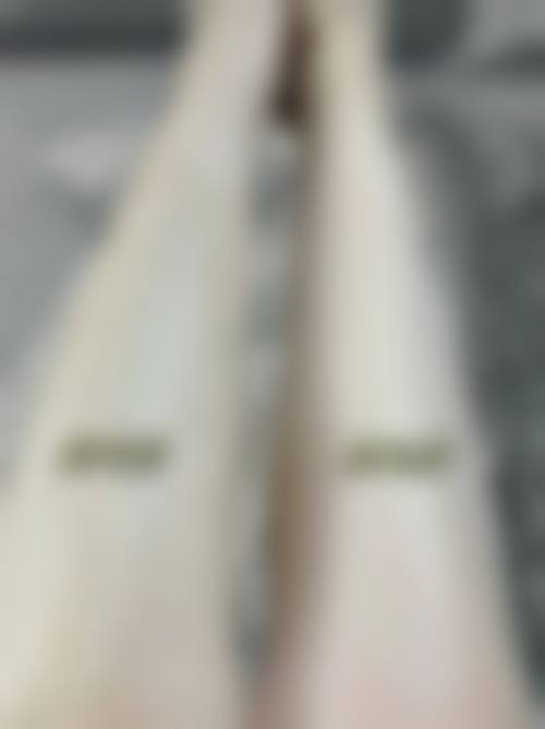 八、石家庄熙子医疗美容诊所怎么预约？