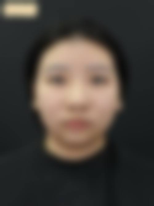 六、温州鹿城铂诗玥整形医院口碑如何？