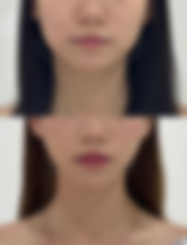 八、贛州华美医疗美容门诊部怎么预约？