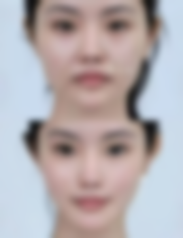 七、阜南汇伊美曹伟医生怎么预约？