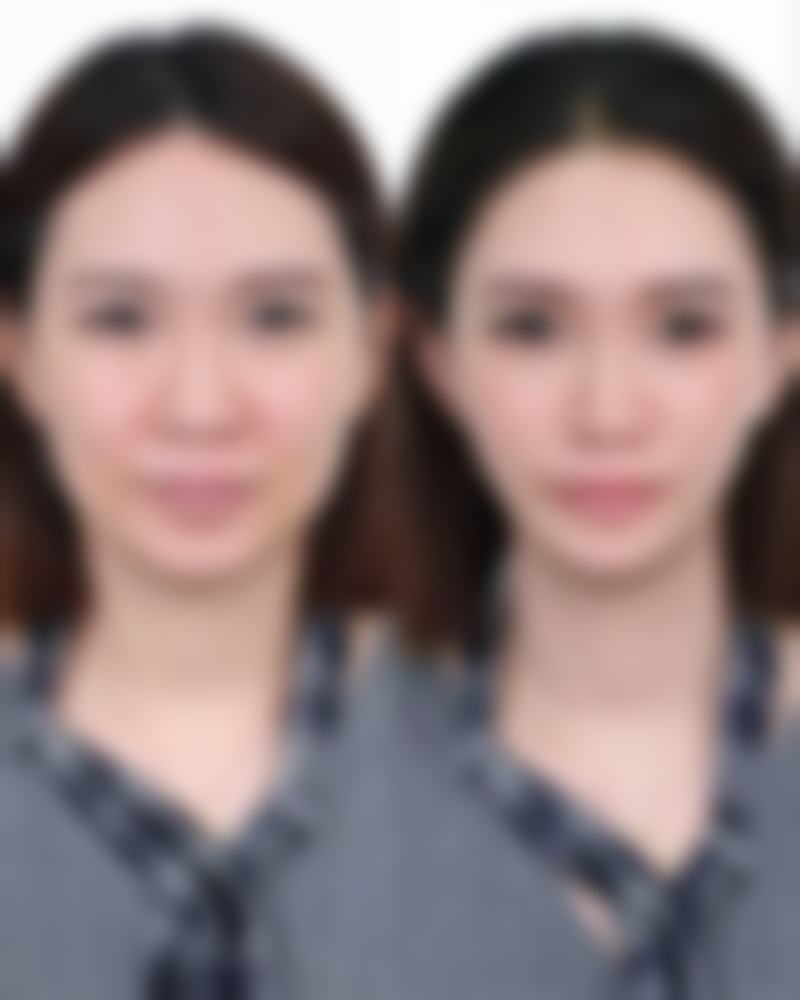 容貌变化大换身份证所需证明