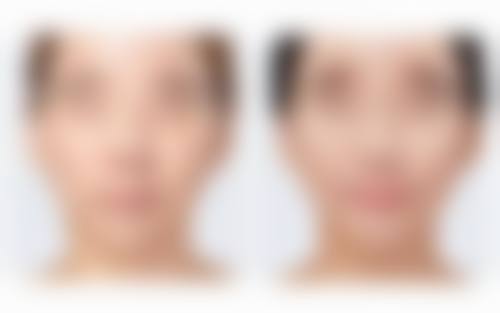 影响脸上疤痕自动修复的因素