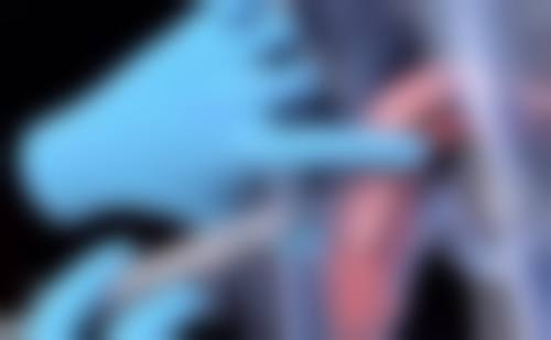 泡泡眼做双眼皮的可行性分析