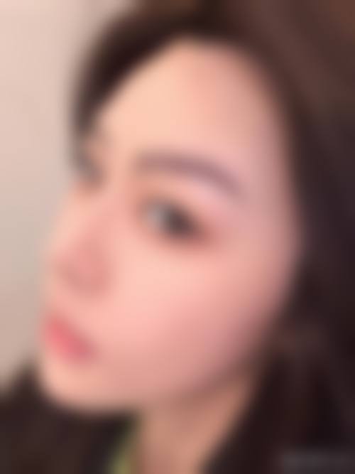 四、邹城欣灿医疗美容诊所特色项目