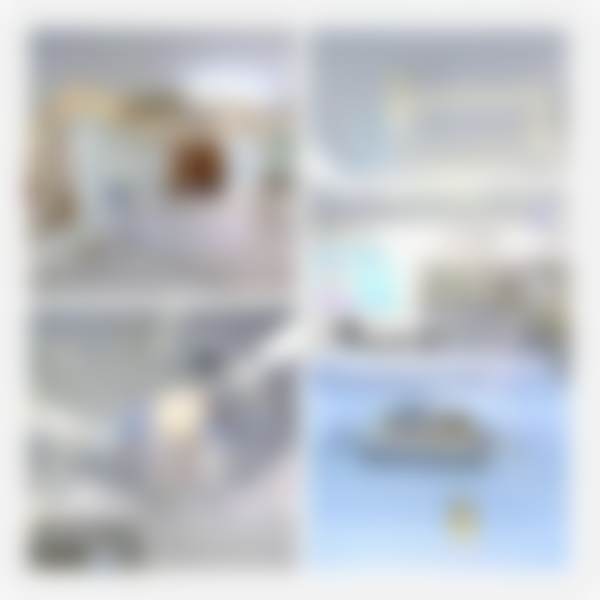 仿生理综合隆鼻——打造自然美鼻