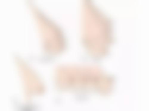 五、北京漾缇医疗美容冯曌曌医生技术怎么样？