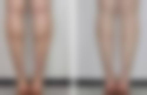 张益秀医生口碑评价及真人实例反馈