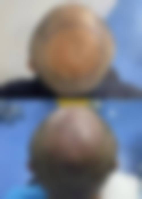 六、中山九九医疗美容门诊部口碑如何？