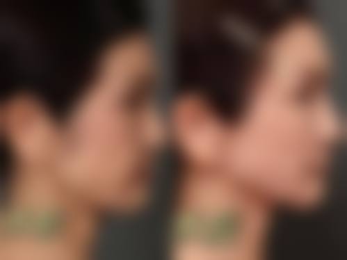 八、广州爱博恩妇产医院医学美容科怎么预约？