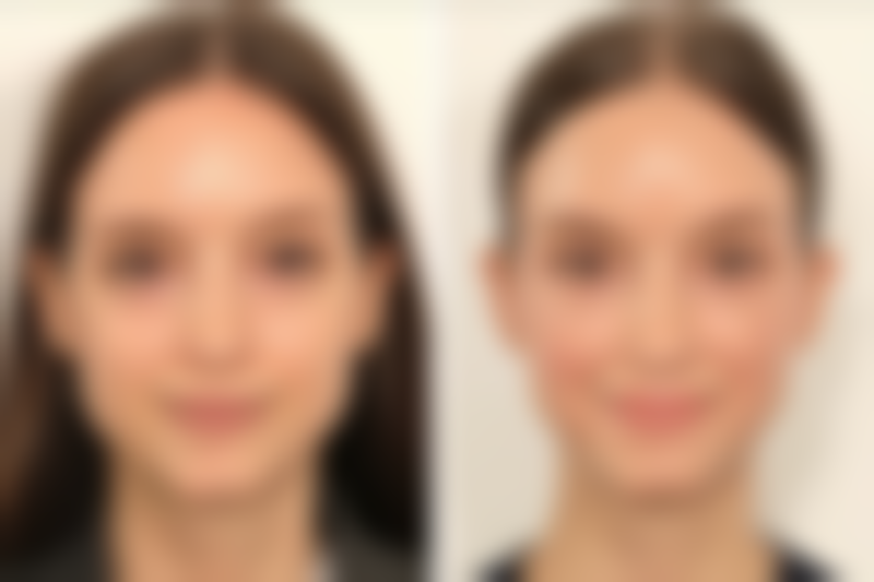 三、城本 筑波医生介绍