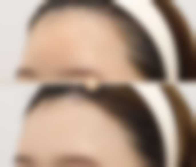 五、福州泓宇医疗美容诊所收费价格表