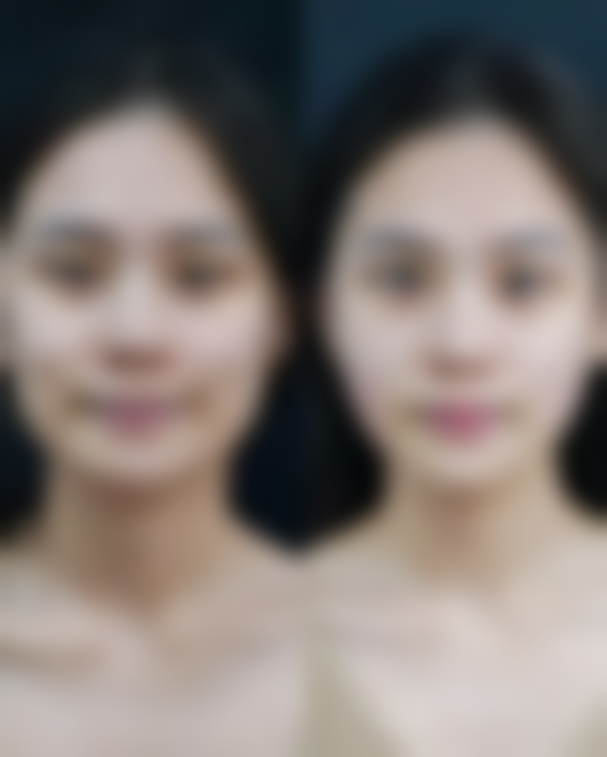 二、金柳廷医生擅长项目