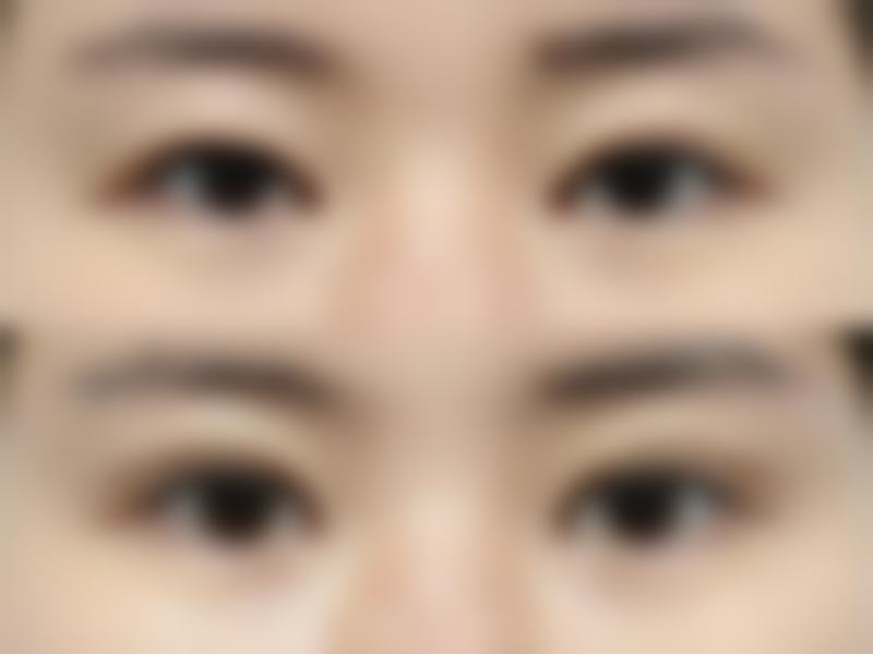 消肿食材加速修复进程