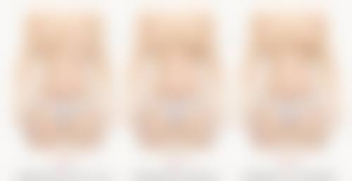 隆胸的假体破裂按流程处理