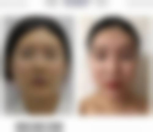 七、成都华星晶肤钟玉娟医生怎么预约？