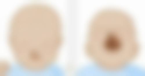 八、深圳儿童医院怎么预约？