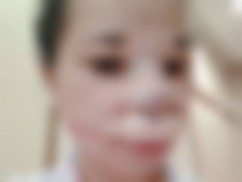 五、成都华星晶肤钟玉娟医生技术怎么样？