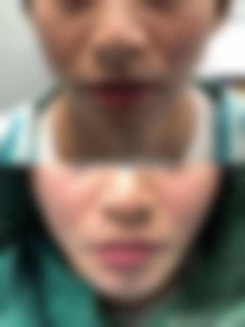 六、淮北吴长淮医疗美容诊所口碑如何？
