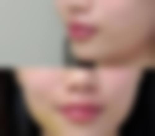 六、盘锦京韩整形美容医院口碑如何？