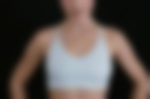 六、东莞科医能整形医疗美容口碑如何？
