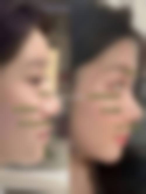 四、上饶爵美整形医院特色项目