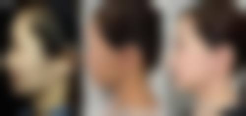 六、榆林天一灵性医疗美容诊所口碑如何？