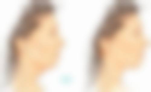 六、郑州至美医疗美容尹锡荣医生口碑评价及真人实例反馈