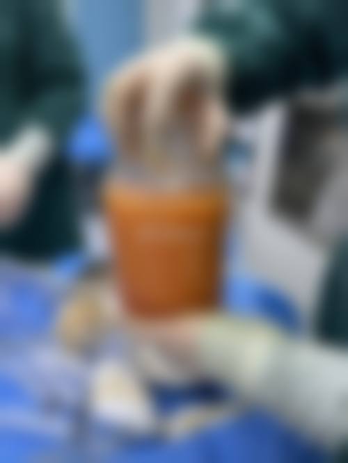 五、韩国江南Lareine医院收费价格表