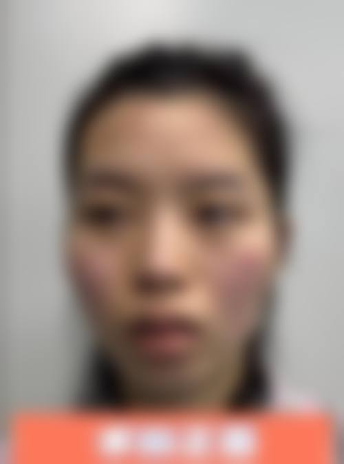五、贵阳利美康整形外科医院收费价格表