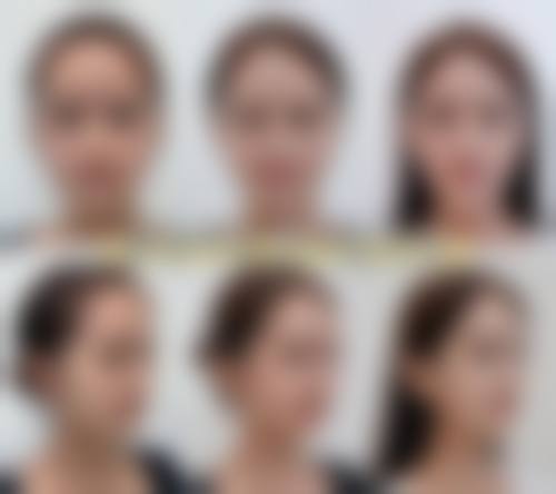 四、贵阳利美康整形外科医院特色项目