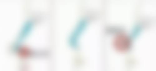 淡化凹陷疤痕的日常注意事项