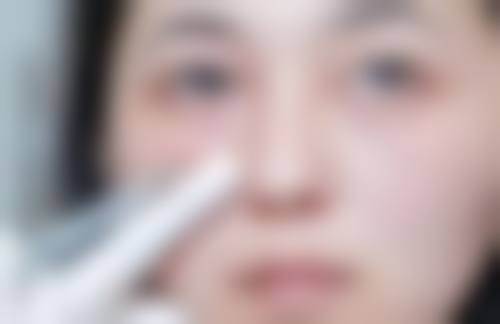 五、重庆尚韩医疗美容刘兴振医生技术怎么样？