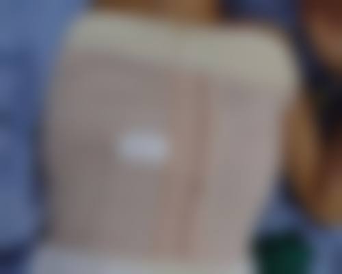 五、深圳阿芙罗医疗美容于金刚医生技术怎么样?