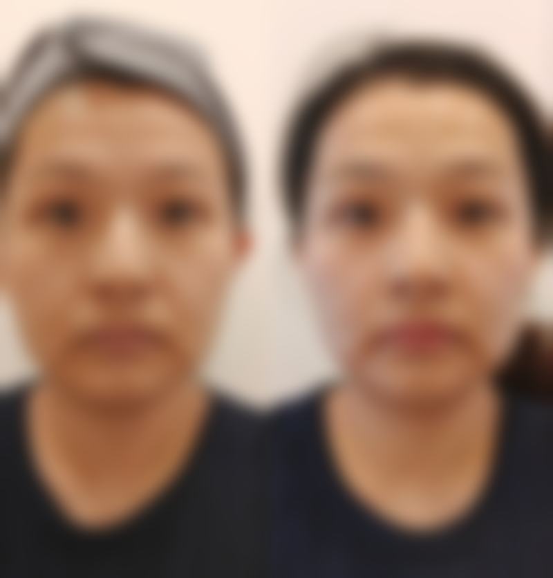 四、海口红妆整形医疗美容姚志文医生坐诊医院