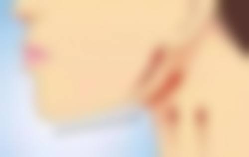日常护理注意事项