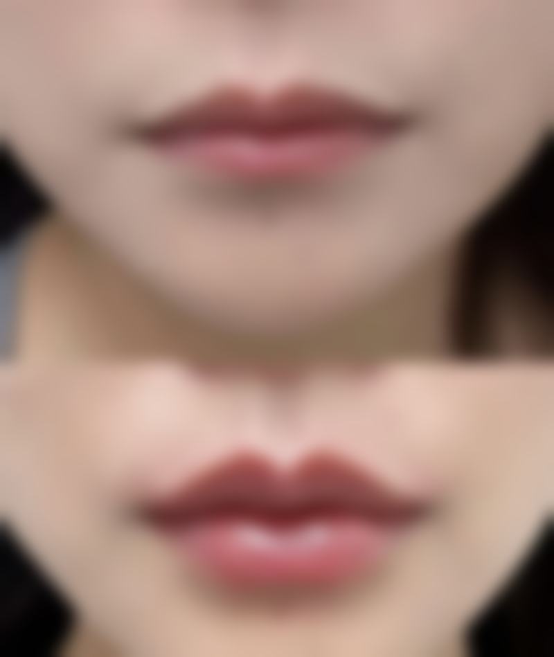 五、丽江美柏瑞美容陈取权医生技术怎么样?