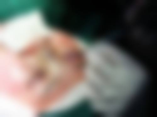 五、深圳韩美整形医院收费价格表