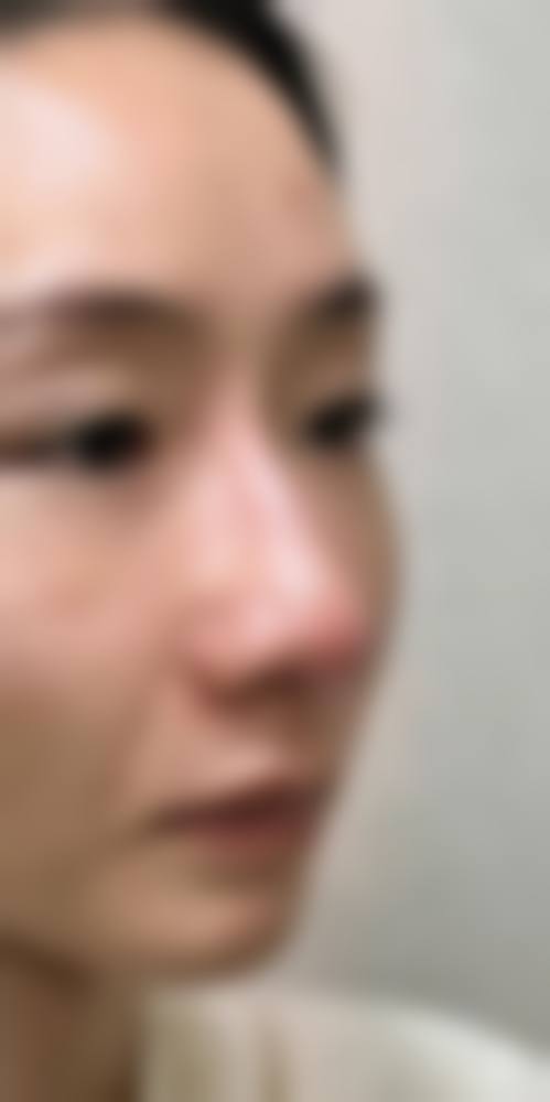 六、长沙美宸(宇美)医疗美容门诊部口碑如何?