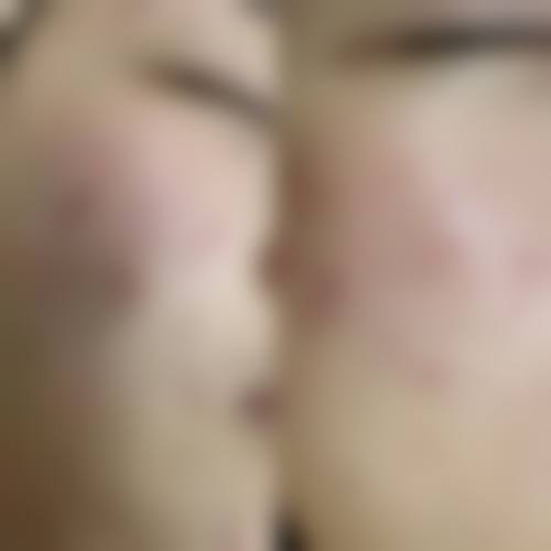 五、丽水庄莉医疗美容诊所收费价格表