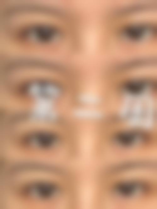 六、深圳韩美整形医院口碑如何?