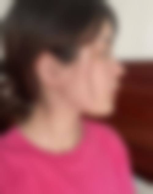 五、溧阳上兴玖美整形医院收费价格表