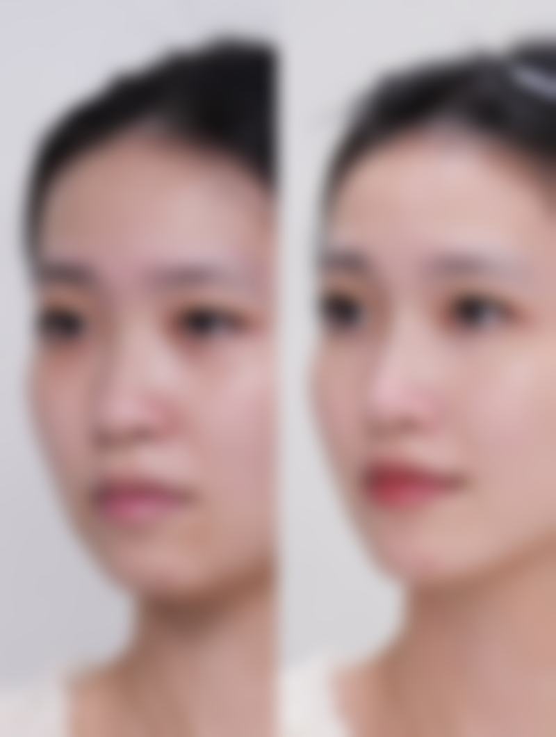 三、揭阳张小红医疗美容诊所医生介绍