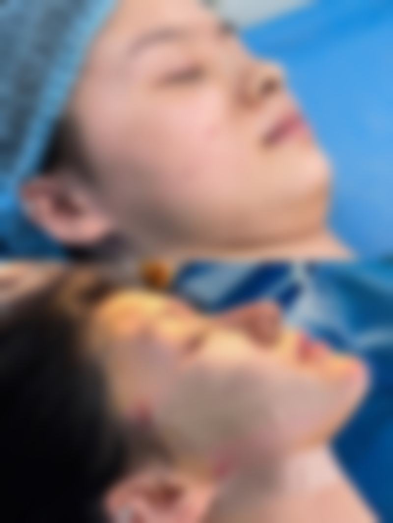 二、北京伊美尔郭海燕医生擅长项目